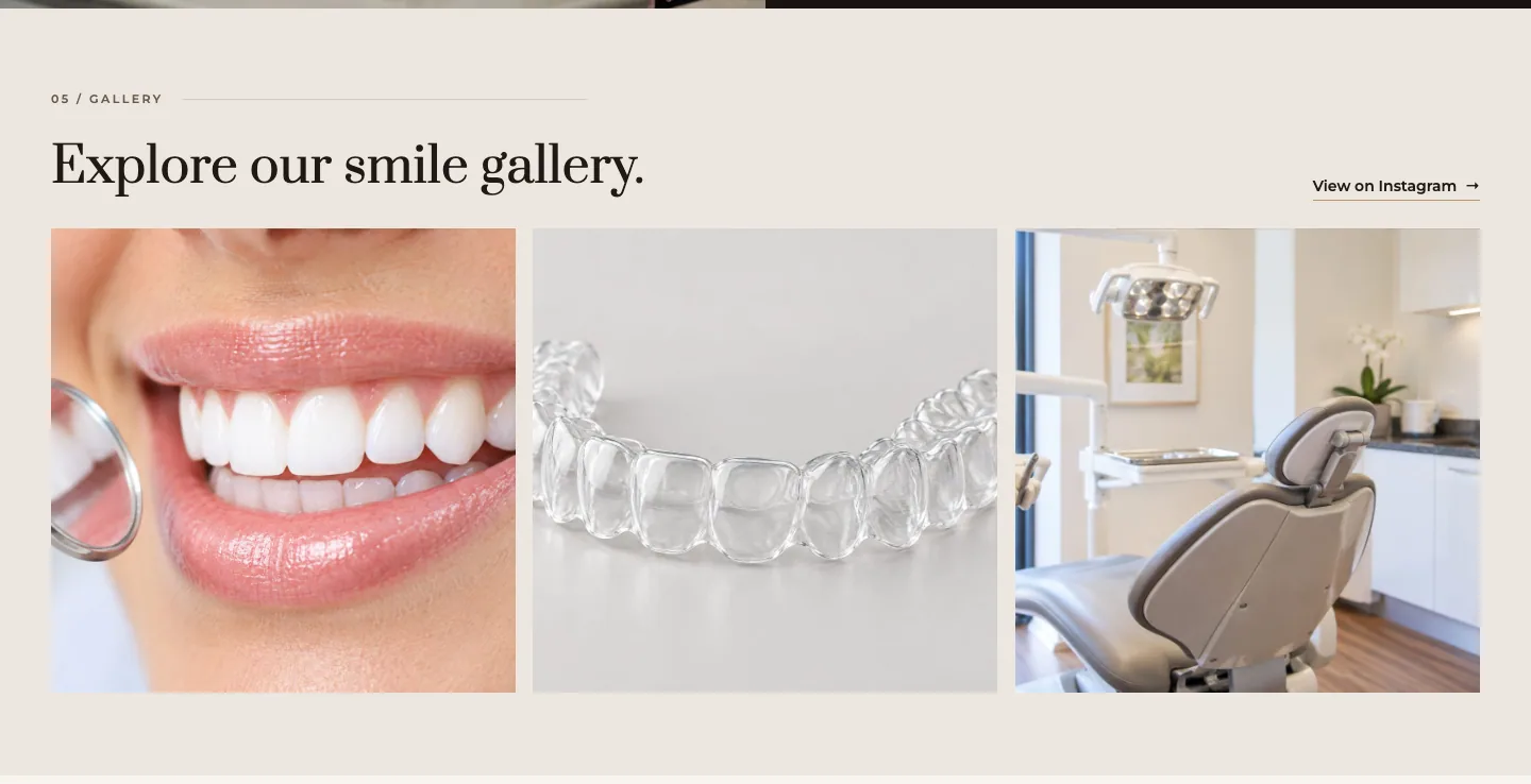 Explore our smile gallery.